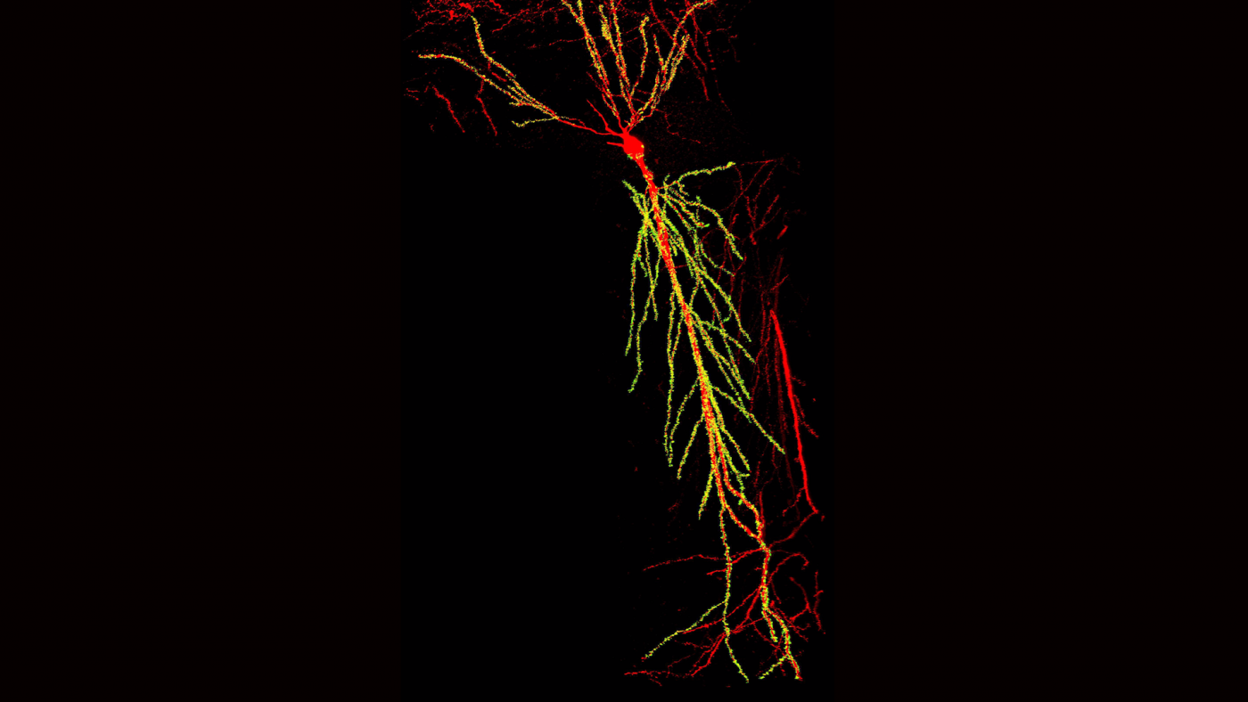 Piramissejt térbeli rekonstrukciója az egér hippokampusz CA1 régiójában. A sejt dendritfája pirossal jelölve, a sárga pontok pedig a dendritekre érkező serkentő szinaptikus kapcsolatokat jelölik. Egyetlen sejt több mint 10.000 serkentő szinapszist kap. (Forrás: Daniel Iascone | Polleux lab) 